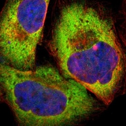 PPP2R5E Antibody, Novus Biologicals:Antibodies:Primary Antibodies